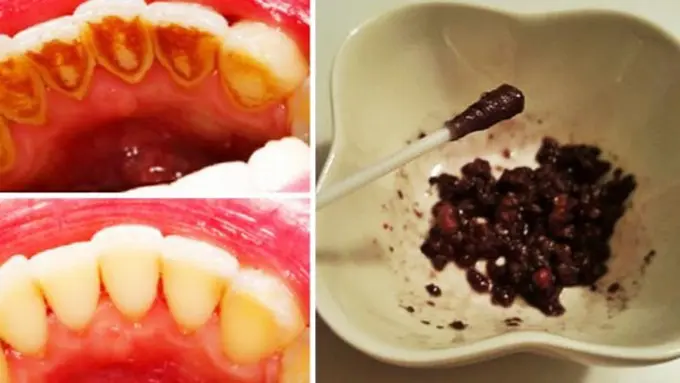 Foto: copyright mylifestyle.com