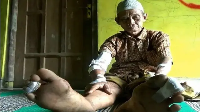 2 Warga Purworejo Diserang Babi Hutan Saat Mencari Rumput