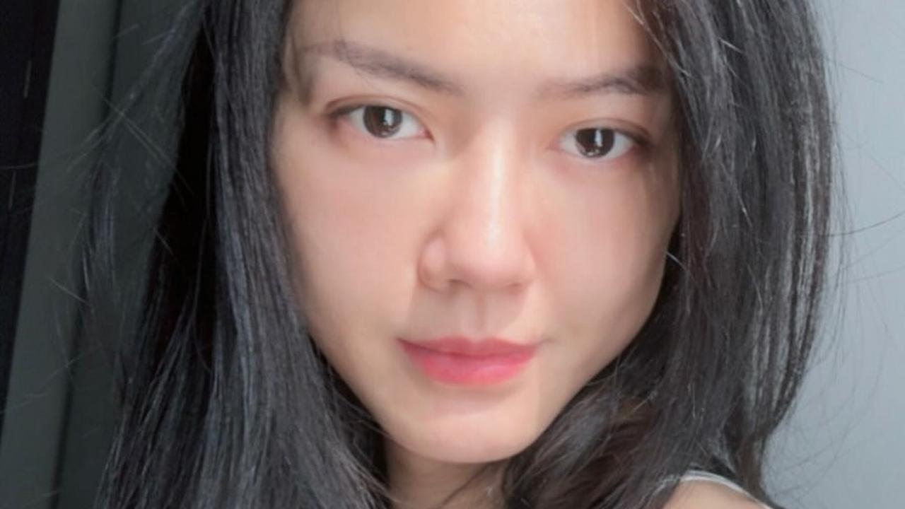 Kini Lakukan Fat Graft, Ini 8 Potret Nita Gunawan Sebelum Wajahnya Dimasuki Lemak - Disebut Mirip Hinata hingga Kempot