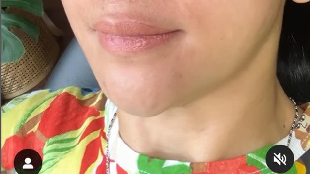 Santai Meski Tuai Cibiran, Potret Farida Nurhan Kembali Oplas Hidung Demi Penampilan Maksimal