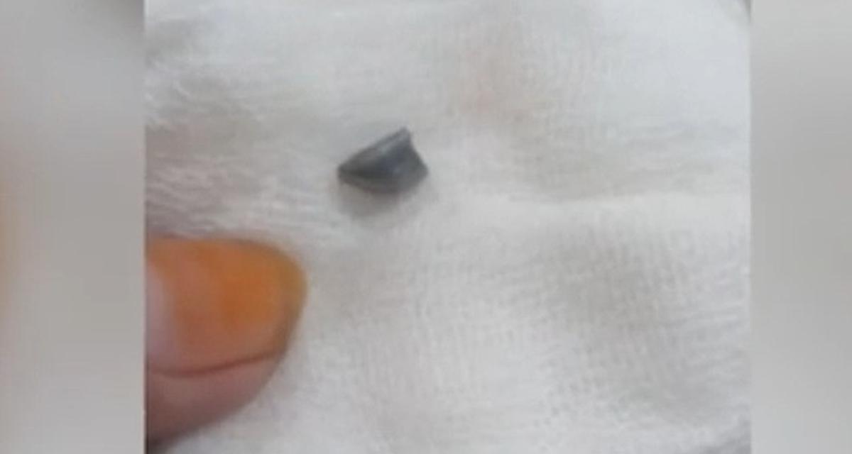 Asyik Main Handphone di Depan Rumah, Bocah di Gowa Terkena Peluru Nyasar
