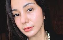 Kirana Larasati Jalani Operasi Plastik di Thailand, Hidung Mancung Habiskan Biaya Hingga Rp200 Juta