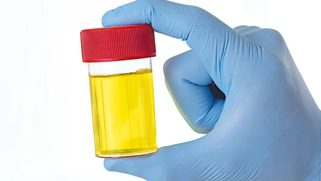 Minum Urine Bikin Badan Sehat, Benarkah?