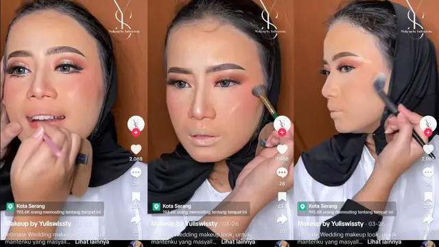 Finishing: Riasan Pengantin untuk Penderita Vitiligo