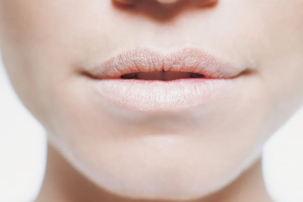 Ingin Bibir Tidak Kering? Coba Bahan Alami Ini