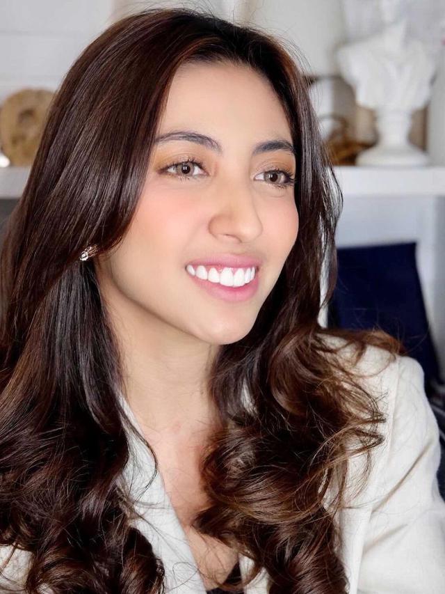 6 Potret Terbaru Selebgram Vicky Alaydrus Tampil Tanpa Hijab, Curi Perhatian