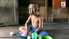 Rahmad Lubis (11) harus menahan sakit dimatanya selama sebelas tahun.