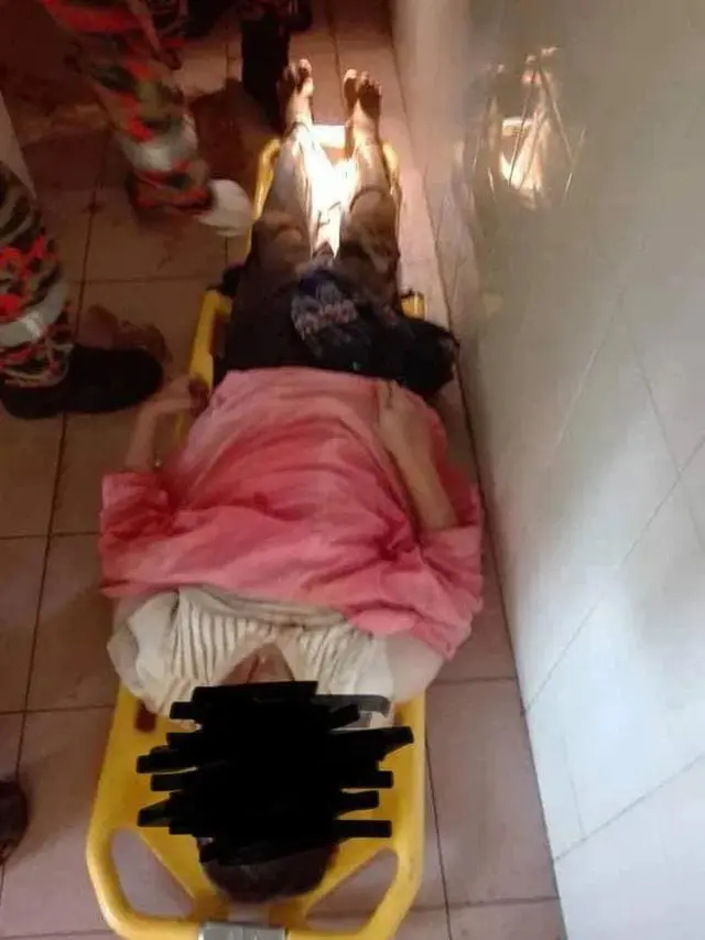 Terpeleset di WC Jongkok, Tubuh Wanita Ini Terperosok Lubang Sampai Sedalam Dada