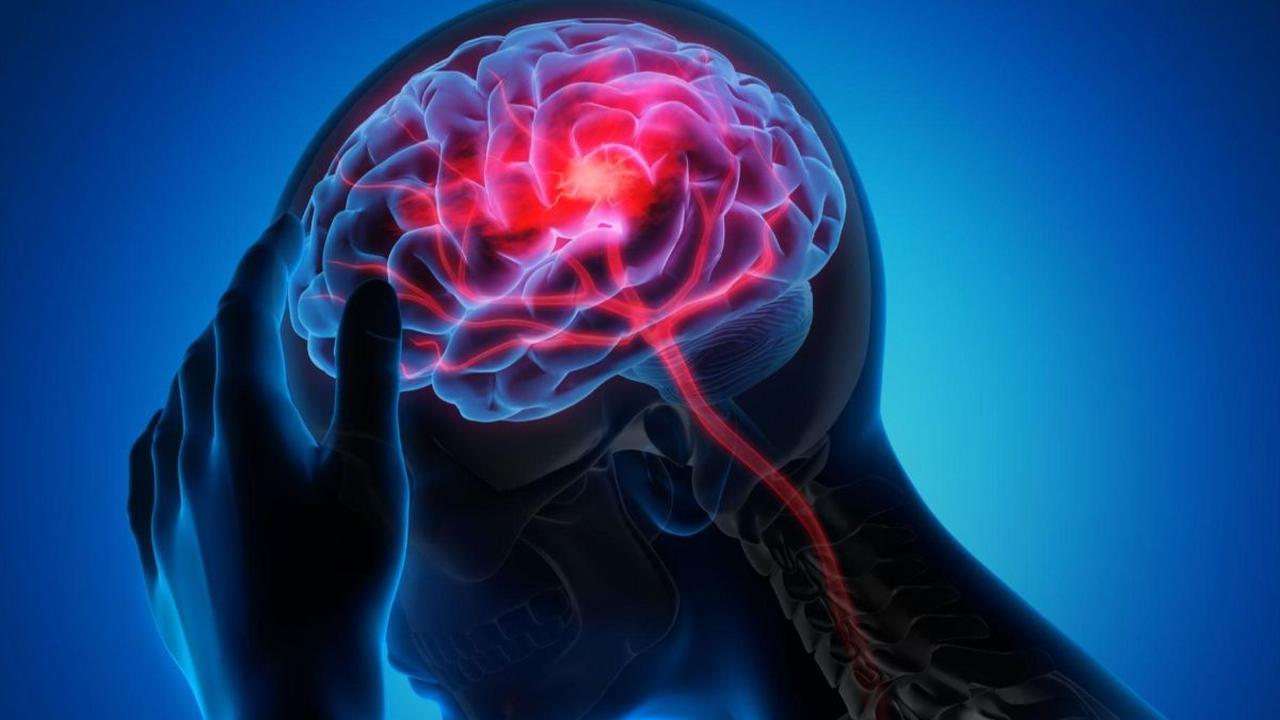 Faktor Risiko Penyakit Stroke