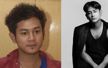 15 Transformasi Artis Sebelum dan Sesudah Suntik Botoks, Nomor 7 Pangling Banget