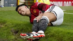 Pemain Manchester United, Lisandro Martinez mengeram kesakitan saat laga lanjutan Liga Inggris 2023/2024 antara Manchester United melawan West Ham United di Old Trafford, Manchester, Inggris, Minggu (04/02/2024). (AP Photo/Dave Thompson)