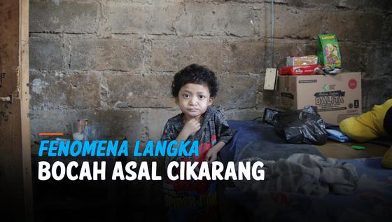 VIDEO: Fenomena Langka, Tubuh Bocah Asal Cikarang Harus Selalu Dibasahi Air