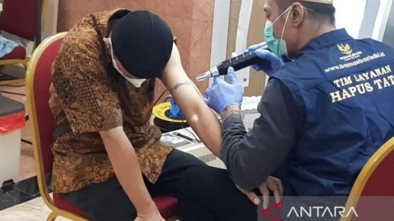 Baznas DKI Kembali Buka Pendaftaran Hapus Tato Gratis Ramadhan 2026, Targetkan 1.000 Peserta