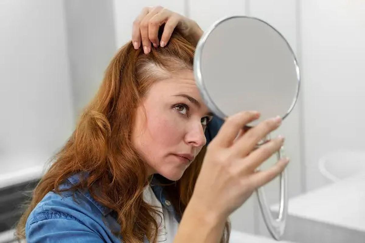 Benarkah Merokok Bisa Menyebabkan Rambut Rontok? Ini Fakta yang Perlu Diketahui