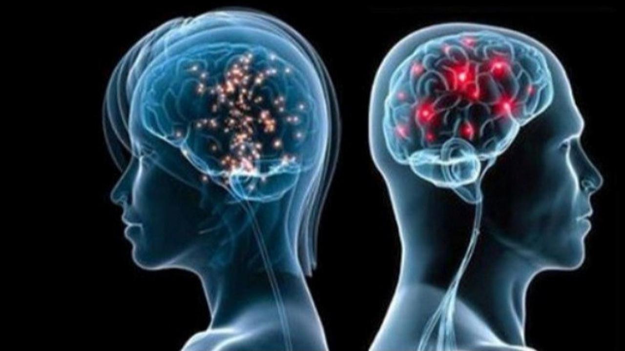 Penyebab Pecahnya Pembuluh Darah di Otak, Faktor Risiko yang Harus Diwaspadai