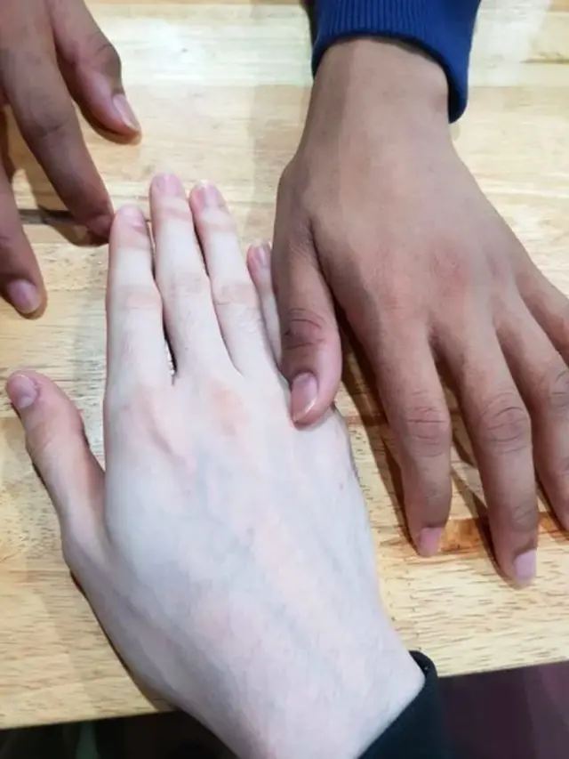 Viral Krim Pemutih yang Hasilnya Bikin Warganet Bergidik