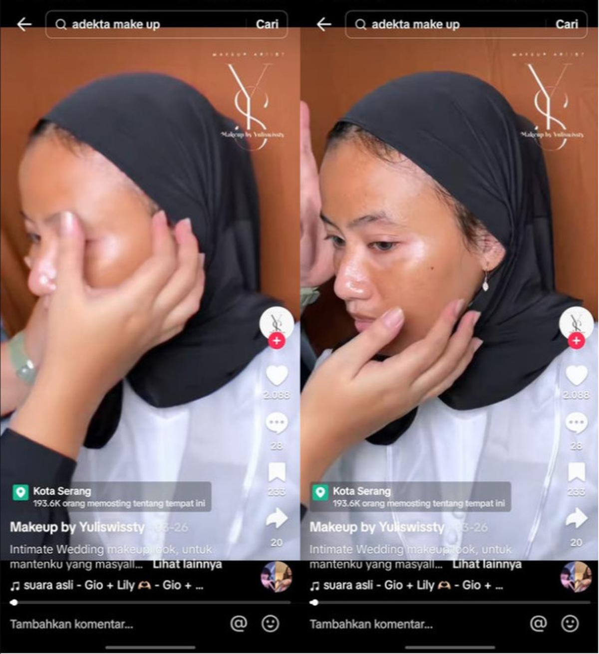 Skin Preparation: Riasan Pengantin untuk Penderita Vitiligo