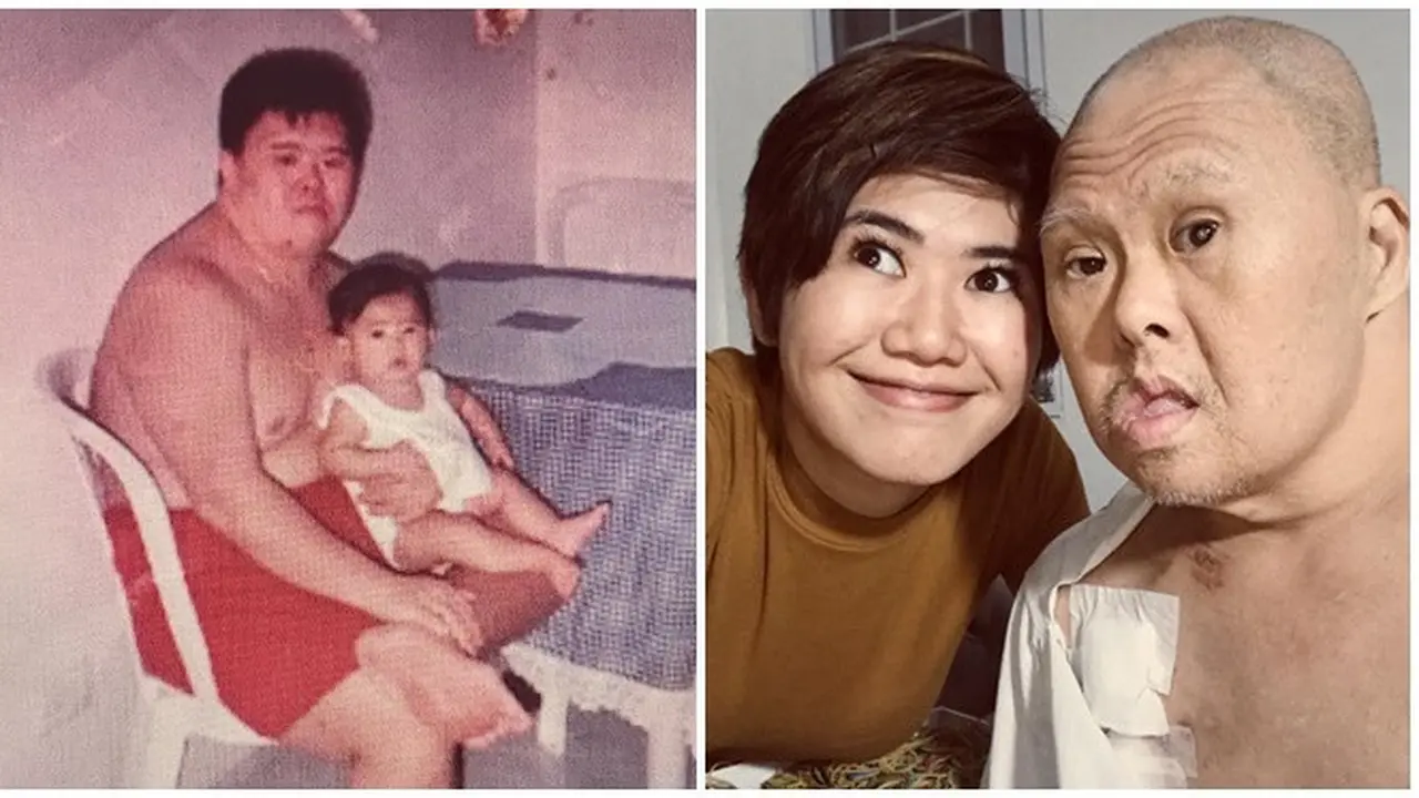 Potret Anak Tumbuh Bersama Ayah Penyandang Down Syndrome, Kisahnya Bikin Haru
