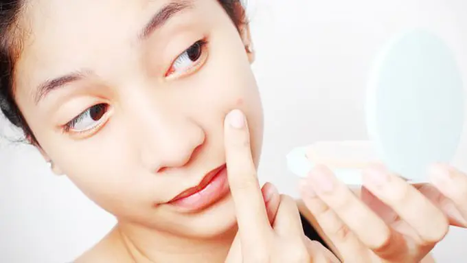 Stres picu jerawat/copyright Shutterstock.com