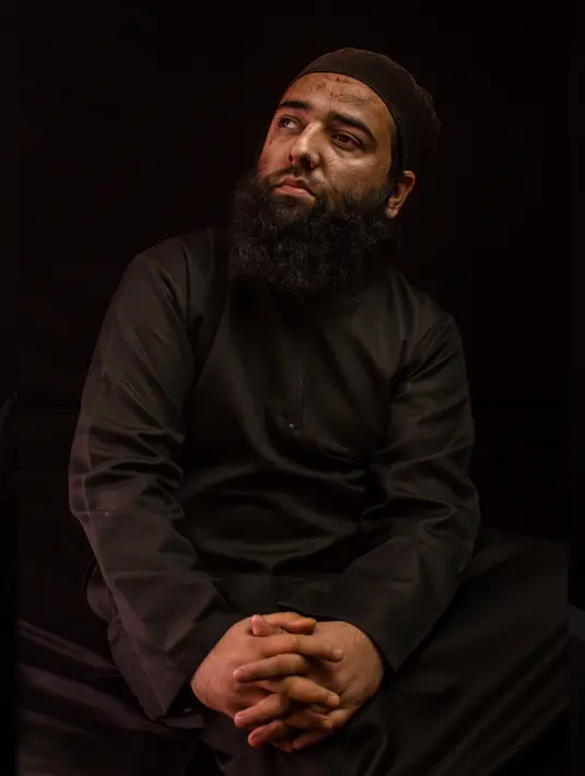 Aamir Kabir Beigh berpose di sebuah desa Baramulla, Kashmir, India 30 November 2016. Aamir kehilangan matanya pada 2010. Lebih dari enam ribu anak muda mengalami kebutaan akibat peluru logam saat aksi menuntut kemerdekaan. (AP Photo / Bernat Armangue)