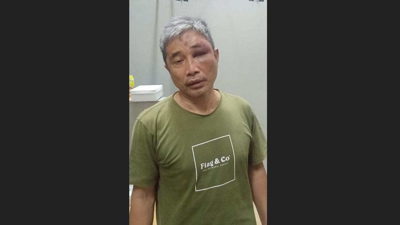 Foto terbaru Muhammad Kece dengan wajah lebam beredar di aplikasi perpesanan.