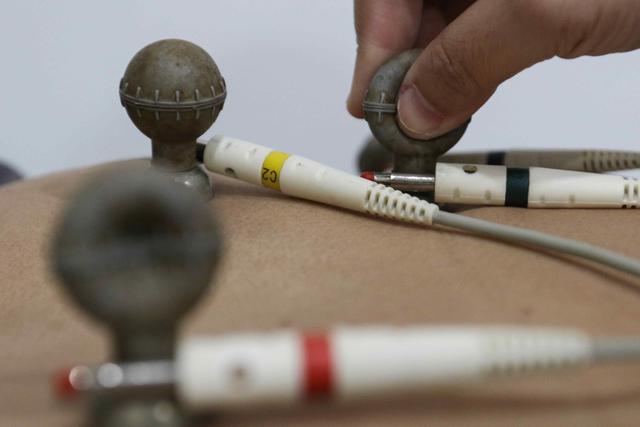 Gejala dan Pencegahan Aritmia di Usia Muda