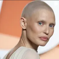 Mengidap kanker ovarium, Bianca Balti tampil kuat dengan rambut botak pasca kemoterapi di red carpet. (foto: Instagram/ Bianca Balti)Tam