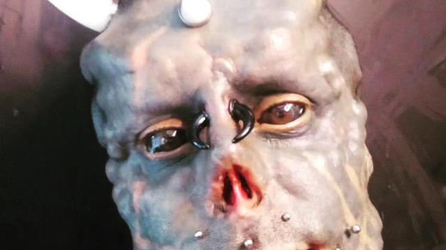 Pria Ini Jalani Operasi untuk Mengubah Tangan Jadi Cakar