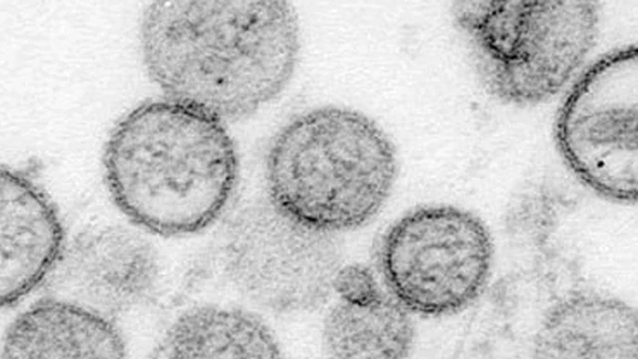 Ilustrasi virus hanta.