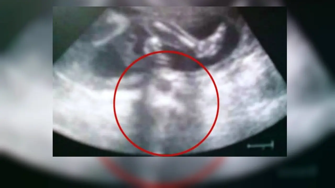 Ada penampakan Yesus di dalam foto USG ini?
