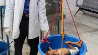 Dokter menimbang seorang bocah yang menderita gizi buruk di rumah sakit di Distrik Abs, Provinsi Haji, Yaman, Rabu (19/9). Konflik berkepanjangan mendorong negara miskin tersebut terjun ke jurang kelaparan. (ESSA AHMED/AFP)