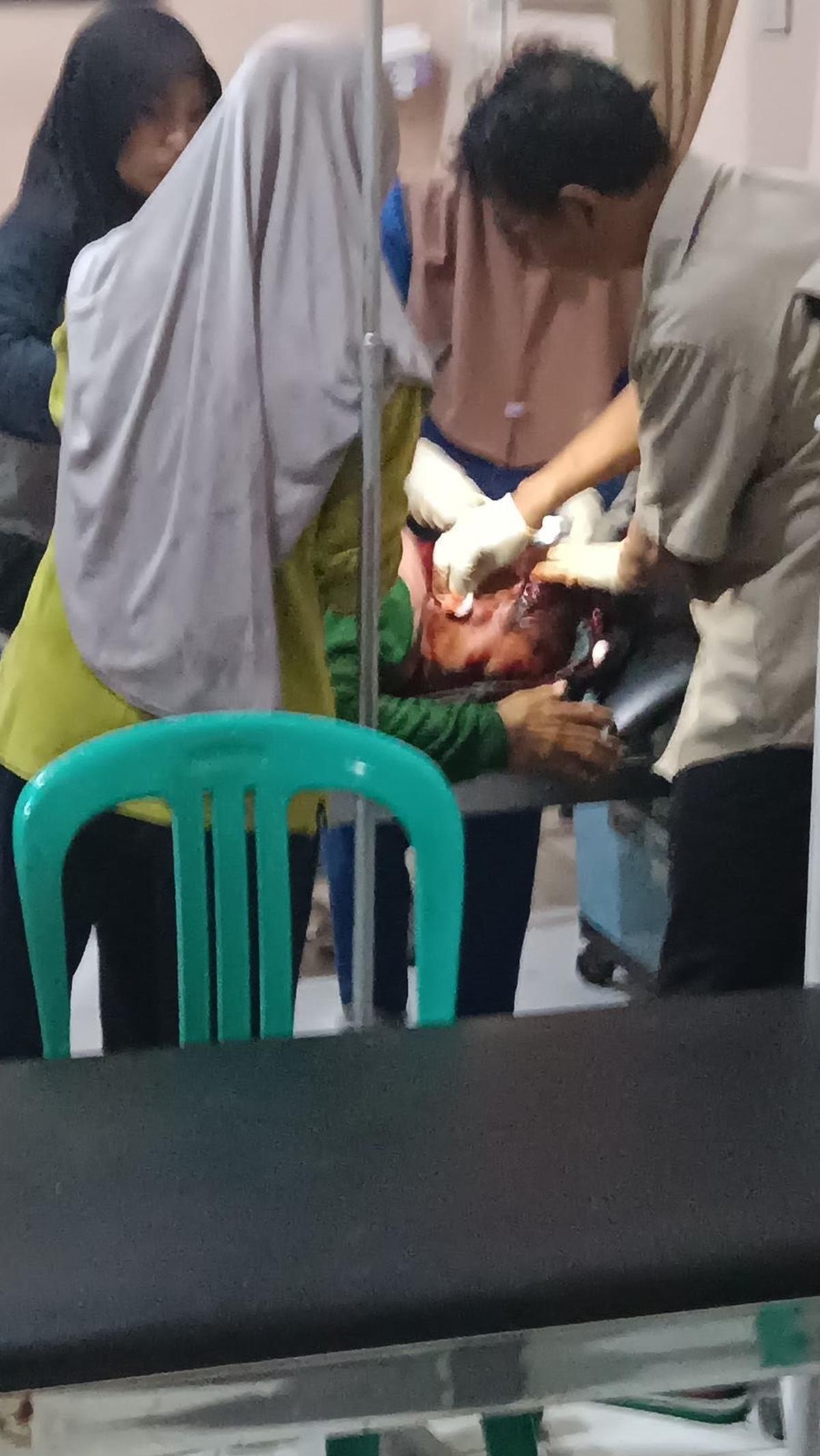 Petani 50 Tahun Diserang Harimau Hingga Kepala Luka Parah 20 Jahitan