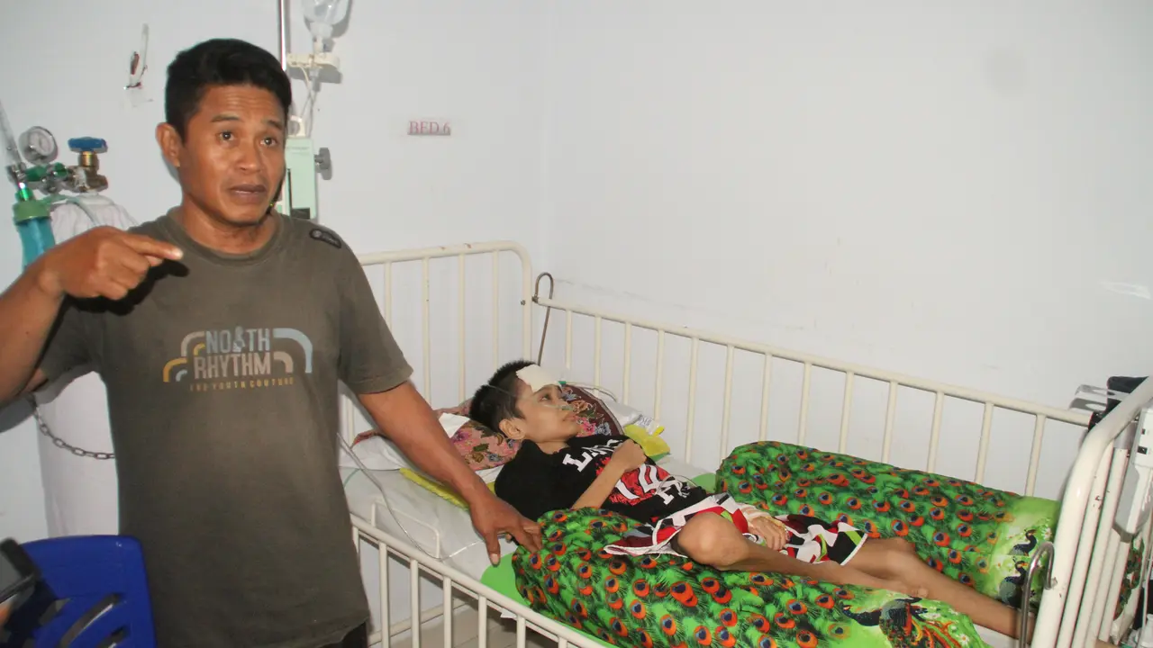 Derita Bocah Gorontalo Pengidap Tumor di Kepala
