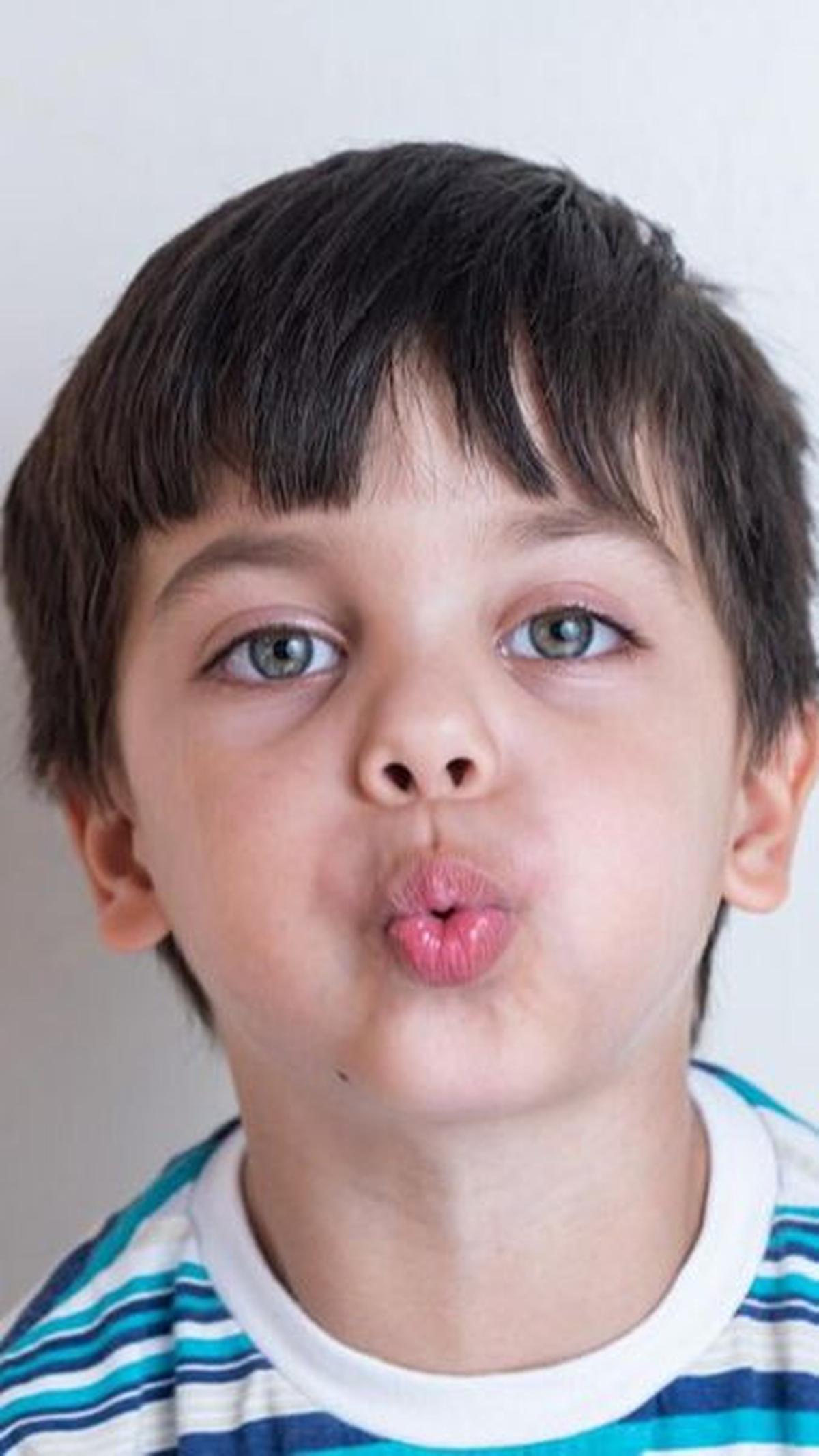 Dengan menerapkan berbagai cara di atas, diharapkan bibir kering pada bayi dan anak bisa diatasi dengan mudah. Namun, jika Si Kecil merasakan nyeri pada bibirnya, bibir anak yang kering disertai keluarnya darah, atau demam, segera konsultasikan ke dokter 