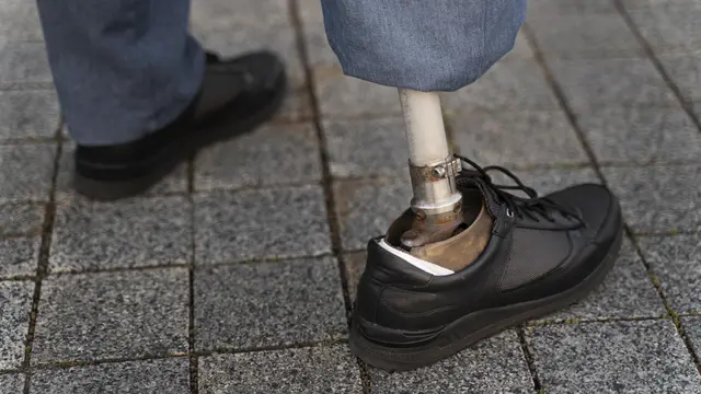 Ilustrasi kaki palsu