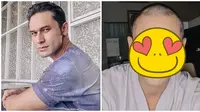 5 Potret Terbaru Indra Bruggman Tampil Botak, Bikin Pangling