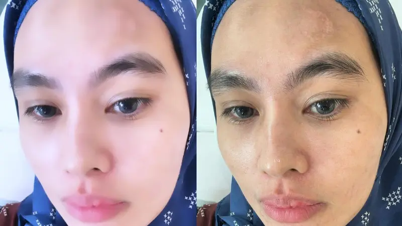 Kartika Putri ungkap wajah tanpa filter kecantikan. (Instagram/ kartikaputriworld)