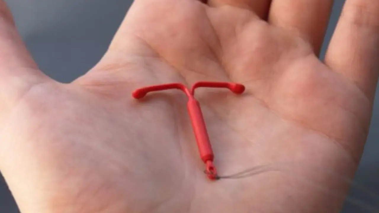 Ilustrasi KB IUD (Foto: Primaya Hospital)