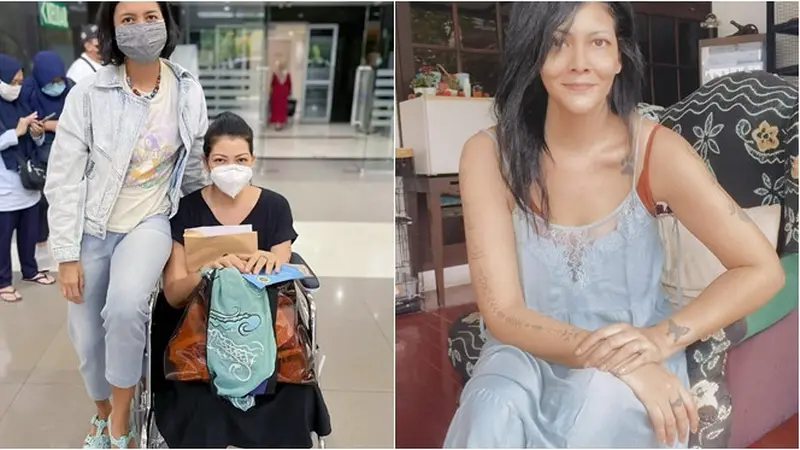 Kondisi Pulih, Ini 6 Potret Terbaru Melanie Subono Usai Operasi Angkat Tumor