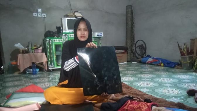 Nurbaiti, warga Kabupaten Ogan Ilir Sumsel menunjukkan hasil rontgen putera ketiganya yang divonis mengidap kanker tulang (Liputan6.com / Nefri Inge)