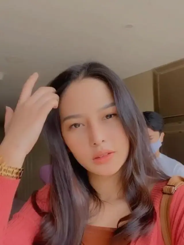 Potret Terbaru Dara Arafah setelah Operasi Rhinoplasty