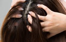 4 Khasiat Jahe untuk Kesehatan Rambut dan Cara Menggunakannya