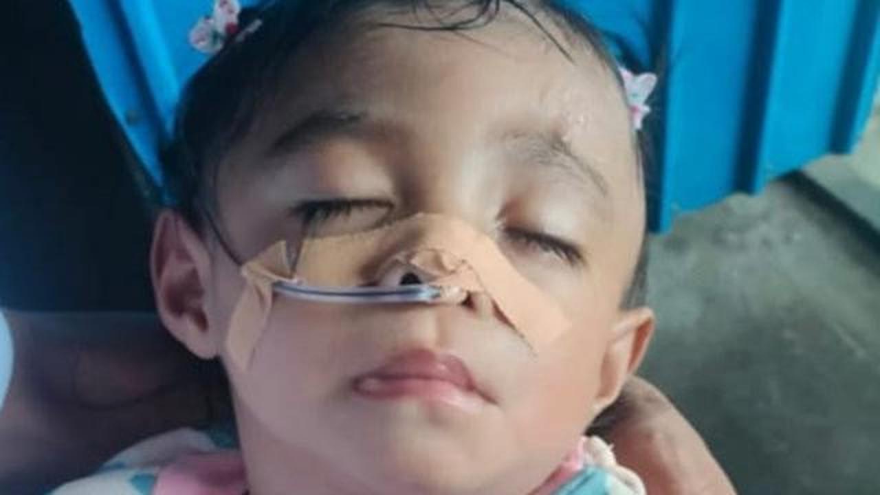 Perjuangan Hidup Yosefasania, Bayi Manggarai yang Berhenti Berobat karena Keterbatasan Biaya
