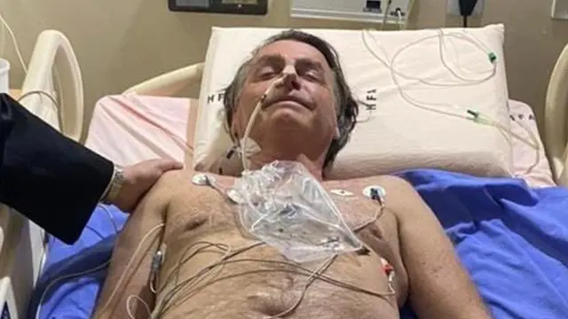 Presiden Brasil Jair Bolsonaro dibawa ke rumah sakit akibat cegukan. (Dok Jair Bolsonaro)