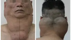 Ia meminum ini secara rutin selama 30 tahun.