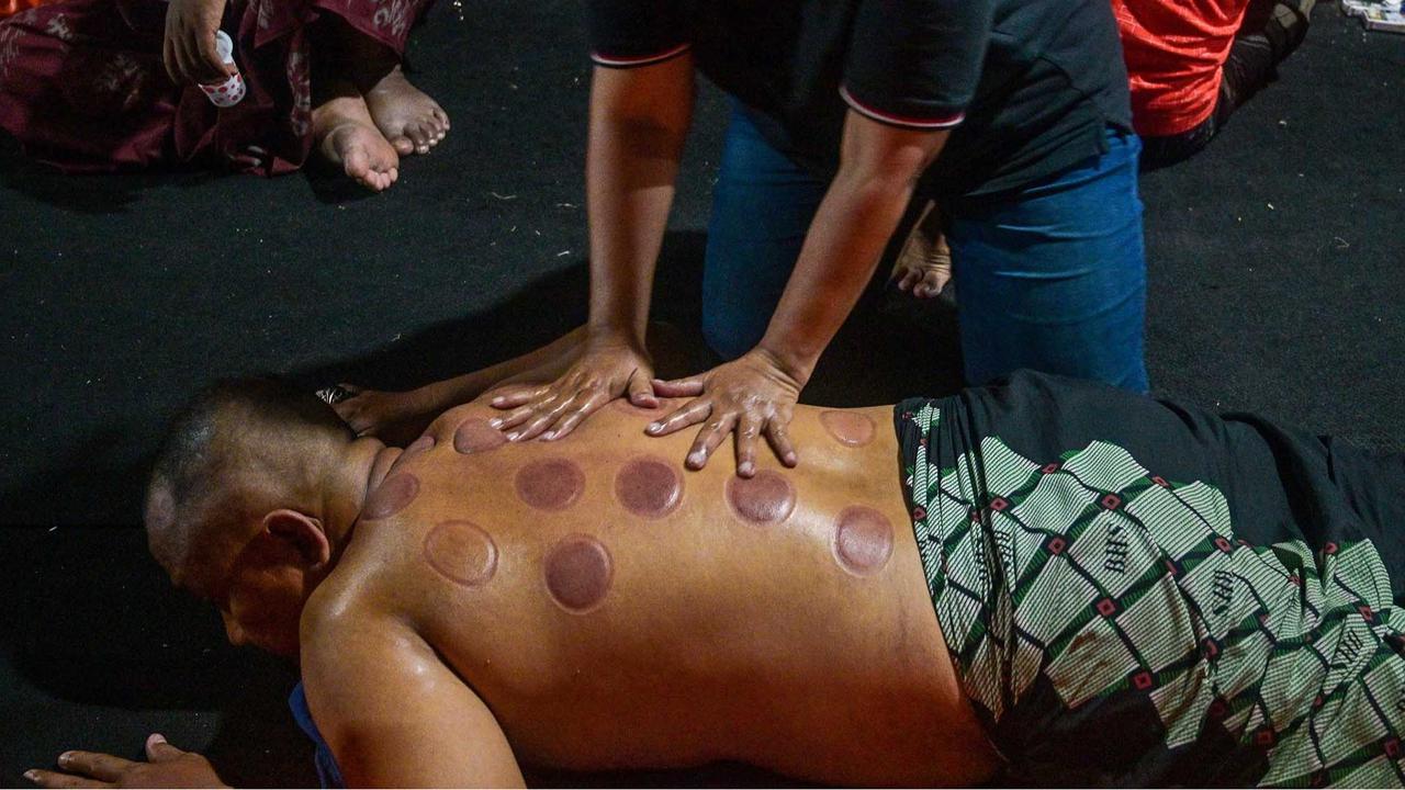 FOTO: Terapi Bekam Tanduk Sapi, Pilihan Lawas di Zaman Modern