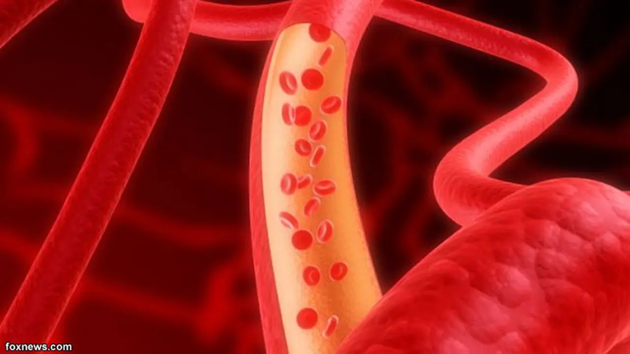 anemia-pikun130802b.jpg