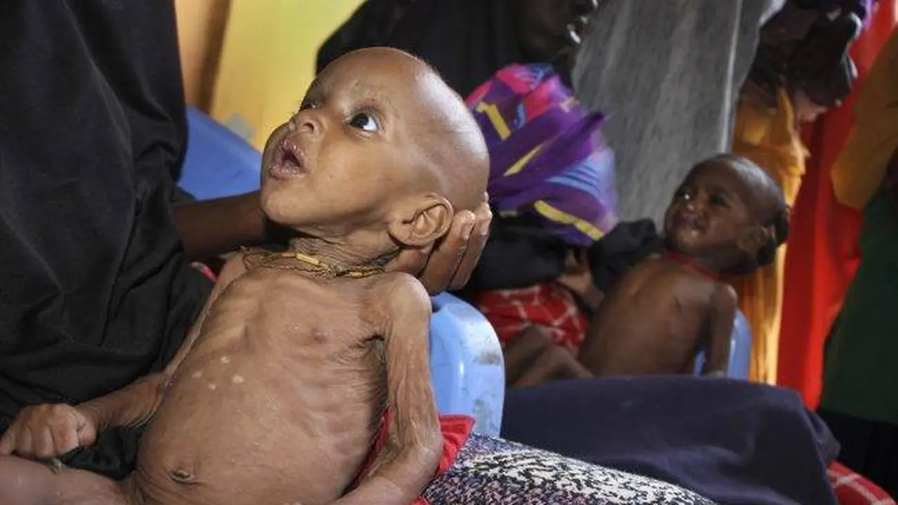  Dalam Dua Hari, 100 Orang Tewas Akibat Kelaparan di Somalia