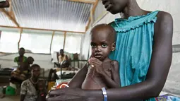 Seorang wanita menggendong anaknya yang terkena penyakit gizi burutk di sebuah klinik di Lankien, Sudan Selatan, (8/4).Setiap bulannya sekitar 150 anak mengalami gizi buruk. (Albert Gonzalez Farran / cds / AFP)