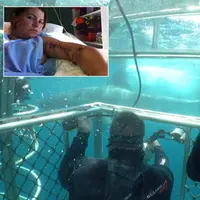 Akibat diserang seekor hiu putih, lengan perempuan ini koyak hingga pembuluh darah arterinya mencuat keluar. Butuh empat tahun hingga pulih.